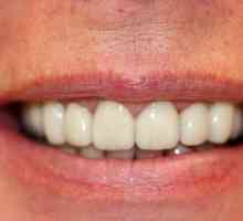 Metalni-keramička zuba. Protetika: cermet