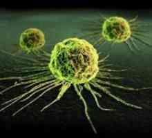 Metode za detekciju stanica raka u ljudskom tijelu