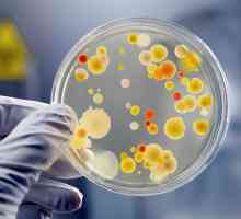 Mikroorganizama - da je u formi života?
