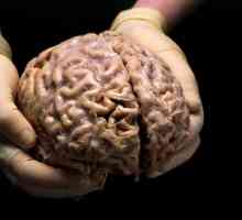 Ljudski mozak: structure