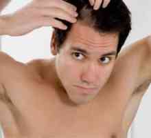 Folk lijekovi za gubitak kose: mišljenja muškaraca i žena