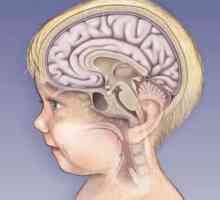 Koliko su ozbiljni posljedice meningitisa u djece?