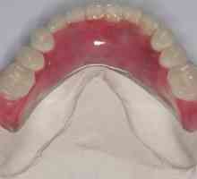 Najlon proteza u odsutnosti zuba i djelomična. Recenzije od najlona proteza