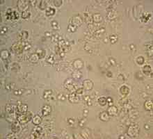 Norma leukocita u urinu kod djece. Bijele krvne stanice u urinu djeteta: normalni, razlozi za…