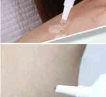 Nuobisong (krema): mišljenja i učinkovitost. Da li uklanja ožiljke gel nuobisong?