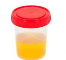 Ono „govori” Analiza urina (dekodiranje) u djece