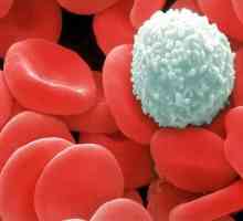 Kao što pokazuje smanjeni bijelih krvnih stanica?