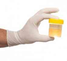 Opći savjeti o tome kako se test urina