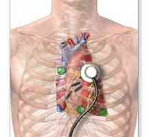 Pregled srca. Ultrazvuk srca: to pokazuje? Metode Survey Heart