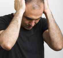 Alopecija areata u muškaraca: tretman narodnih lijekova i lijekova, fotografije, recenzije, razloga