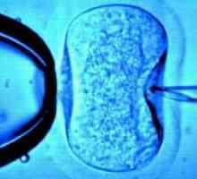 Oplodnja jajne stanice: obilježja prirodnog i umjetnog procesa