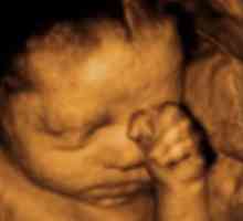 Utvrđivanje spol djeteta na ultrazvuku, što je točnije