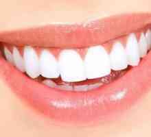 Izbjeljivanje zubi bez oštećenja cakline