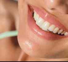 Izbjeljivanje zubi: mišljenja stručnjaka i preporuke