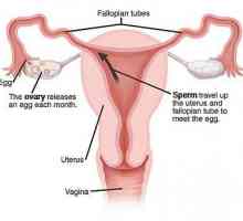Podvezivanje jajovoda u žena: implikacije. Što bi moglo biti posljedice podvezivanje jajovoda?