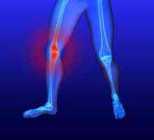 Zašto ozlijediti koljena?