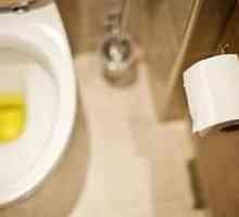 Zašto urin je žuta?