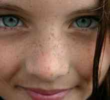 Zašto lice pojaviti tamne mrlje: najvjerojatnije uzrok