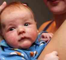 Zašto novorođenče zagnojiti oči?