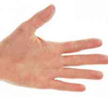 Crvenilo i svrbež na rukama i nogama: tretman