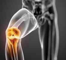 Posljedice ozljeda koljena. Protetika i rehabilitacija