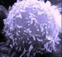 Povećana limfociti: tko je kriv i što učiniti?
