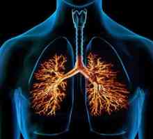 Uzroci i simptomi kroničnog opstruktivnog bronhitisa. Njegova dijagnoza i liječenje