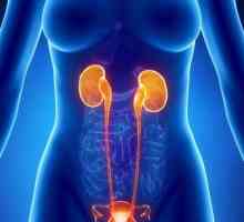 Uzroci i simptomi uretritisa kod žena