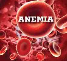 Uzroci, prevenciju i simptomi anemije kod žena: poseban tretman