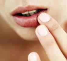 Uzroci i tretman pukotina u uglovima usana