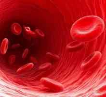 Simptomi i uzroci niskog hemoglobina u žena