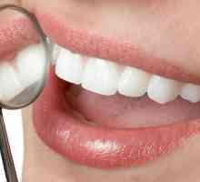 Dentalni problemi: uzroci i liječnička preporuka