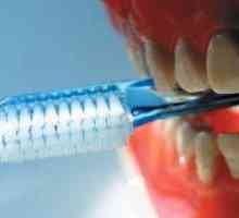 Prevencija karijesa: Zubi koji su zdravi