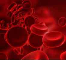 Rak krvi: simptomi kod žena. Simptomi raka krvi u odraslih