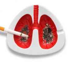 Rak pluća: prvi simptomi. Kako ne propustiti?