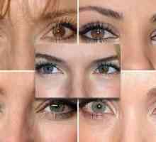 Različite ljudske oči - što to znači?