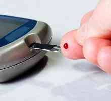 Ocjena glukometre. Kako odabrati mjerenje šećera u krvi? Pregled glukometre
