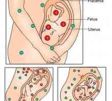 Rezus-konflikt majka i fetus tijekom trudnoće: stol. Imunološki sukob majke i fetusa