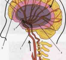 Krpa cerebralnih žila. Prednosti metode dijagnoze