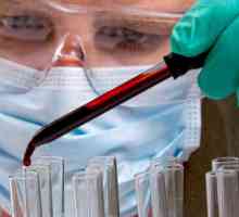 Serološka ispitivanja krvi u dijagnostici bolesti