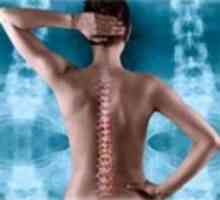 Cervikalne osteochondrosis - tjelovježba i liječenje