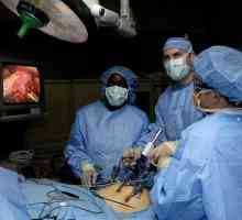 Niska operacija temperatura - laparoskopska