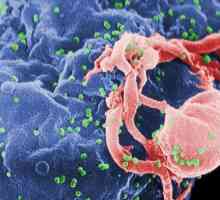 Simptom AIDS: kako se bolest manifestira?
