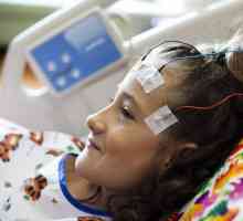 Simptomi epilepsije u djece. Uzroci, dijagnoza, liječenje