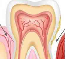 Simptomi parodontne bolesti, dijagnostike i liječenja