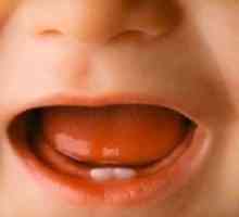 Simptomi reznih zubi u djece: da li roditelji iskustva?