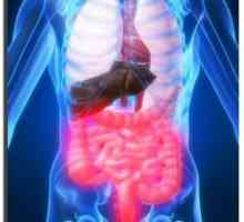 Upalna bolest crijeva: Liječenje, uzroci, simptomi