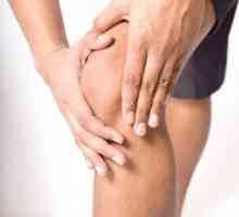 Sinovitis koljena: Liječenje ovisi o uzroku
