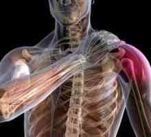 Sport ozljeda ramenog zgloba