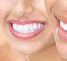 Dentalni profilaksa za prevenciju bolesti zubiju i desni